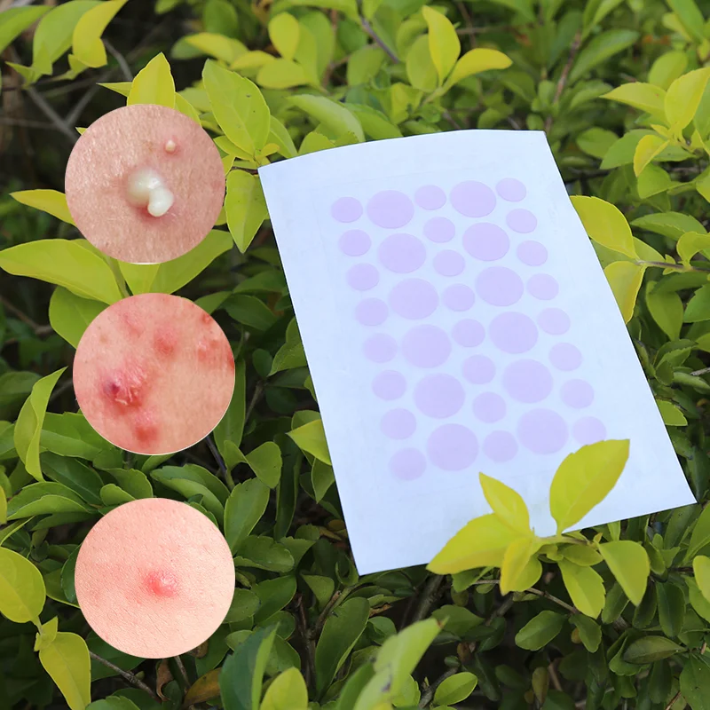 UV-Sensitive Acne Patch - 2