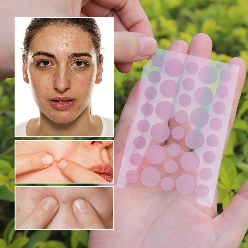 UV-Sensitive Acne Patch - 5